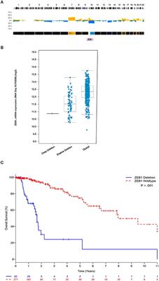 ZEB1 Is a Transcription Factor That Is Prognostic and Predictive in Diffuse Gliomas